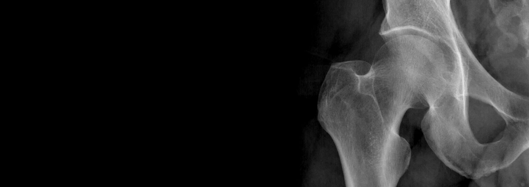 Dr Matt Lyons | North Sydney Orthopaedic and Sports Medicine Centre