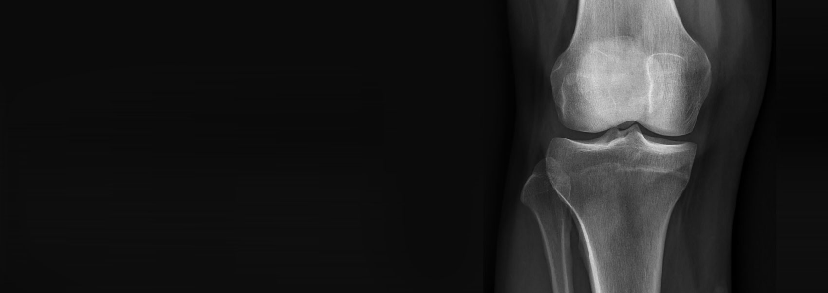 North Sydney Orthopaedic & Sports Medicine Centre